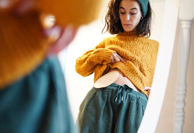 Stomie maladie de crohn